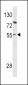 PAX8 Antibody (Center)